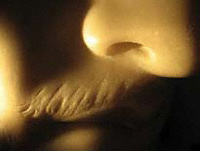 Close-up of the upper lip of the Getty Commodus showing evidence of resurfacing