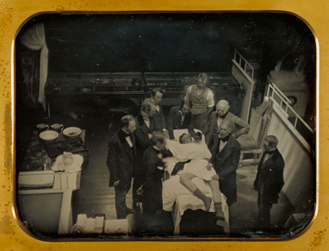 Early Operation Using Ether for Anesthesia